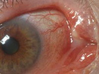 устройство и заболевания глаза